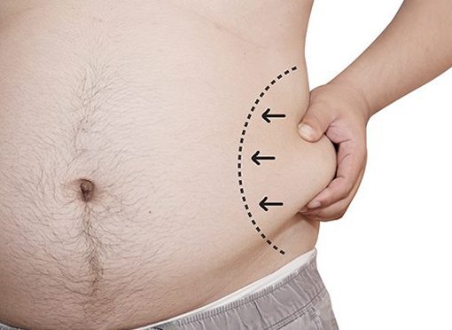 male liposuction patient model pulling his love handle